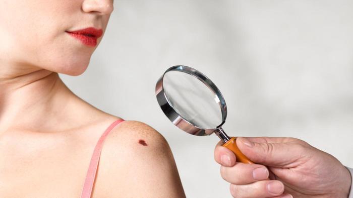 everybody-birthmark_bcd5eaea3ecd021a.jpg